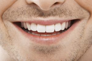 Всегда ли белизна зубов – признак их здоровья